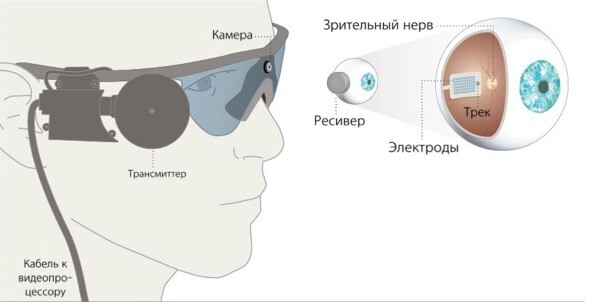 Со-еднинение бионический глаз